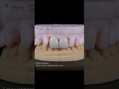 প্রাকৃতিক প্রেসড ইএমইএক্স ফিনিয়ার শক্তি 16 ছায়া ইএমইএক্স দাঁত ফিনিয়ার