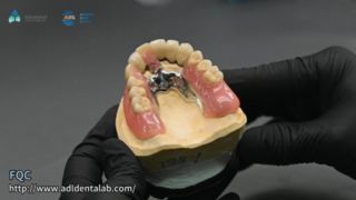 টেলিস্কোপ ক্রাউন যথার্থ সোল্ডারিং গুণমান