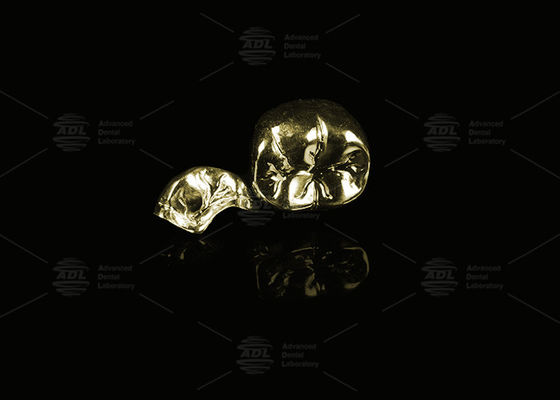 কেনা মূল্যবান খাদ হলুদ স্বর্ণ 60% পূর্ণ ধাতব মুকুট স্বর্ণ সমাপ্তি সম্পূর্ণ ধাতব মুকুট অনলাইনে উৎপাদন