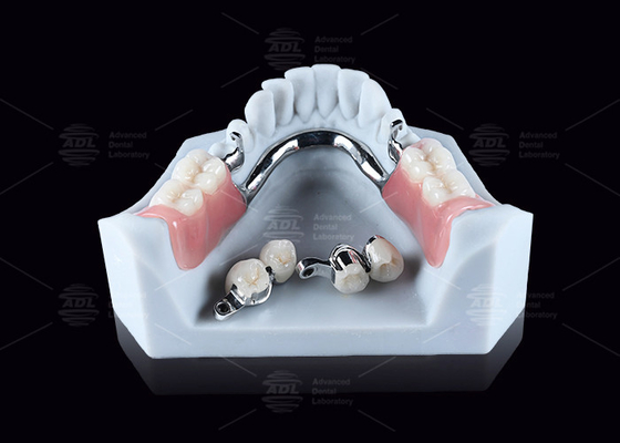 কেনা CEKA M2 3mm অনুভূমিক / উল্লম্ব ক্লিয়ারেন্স সহ টাইটানিয়াম যথার্থ সংযুক্তি অনলাইনে উৎপাদন