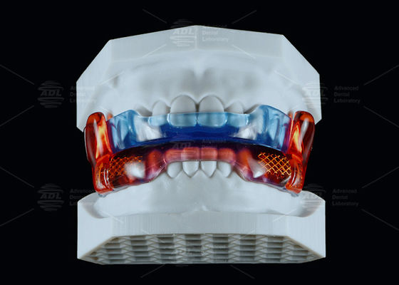 কেনা মেডিকেল গ্রেড সিলিকন এন্টি স্নোরিং ডিভাইস RP উন্নত ঘুমের জন্য অনলাইনে উৎপাদন