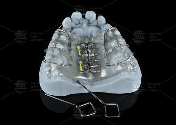 কেনা চায়না ডেন্টাল ল্যাব রঙিন স্টেইনলেস স্টিল স্ক্রু এক্সপান্ডার ম্যাক্সিলা এবং ম্যান্ডিবুল প্রসারণের জন্য অনলাইনে উৎপাদন
