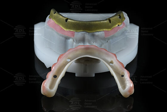 কেনা চীন ডেন্টাল ল্যাব বেশিরভাগ ডেন্টাল ইমপ্লান্ট সিস্টেমের সাথে সামঞ্জস্যপূর্ণ সব 4 এর উপর 72 ঘন্টার মধ্যে অফার টার্নআরাউন্ড সময় এবং অ্যারে প্রযুক্তিগত পরামিতি অনলাইনে উৎপাদন