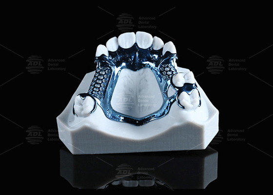 অ্যানোডাইজড থ্রিডি প্রিন্টেড টাইটানিয়াম ফ্রেম হালকা ও সংবেদনশীল ত্বকের জন্য উপযুক্ত