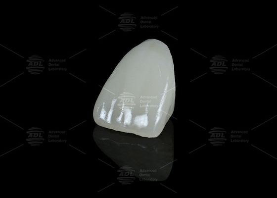 China Dental Lab Hybrid Ceramic Vita Enamic Dental with Translucency for Single Tooth Restorations