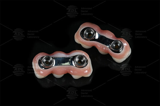 শক্তিশালীকরণ ইমপ্লান্ট বার সিএডি সিএএম সুনির্দিষ্ট ফিট জন্য ডিজাইন করা হয়েছে বেশিরভাগ দাঁতের ইমপ্লান্ট সিস্টেমের সাথে সামঞ্জস্যপূর্ণ দাঁতের পুনরুদ্ধারের সমাধান নিশ্চিত করে চীনা দাঁতের ল্যাব